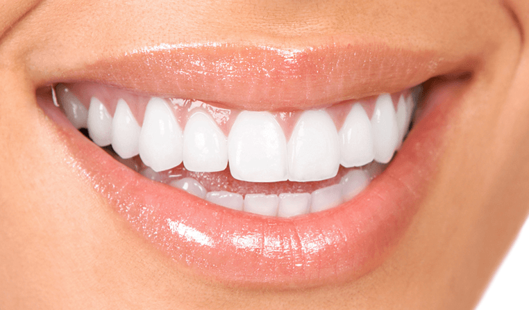 We only use the very best quality teeth whitening products here at