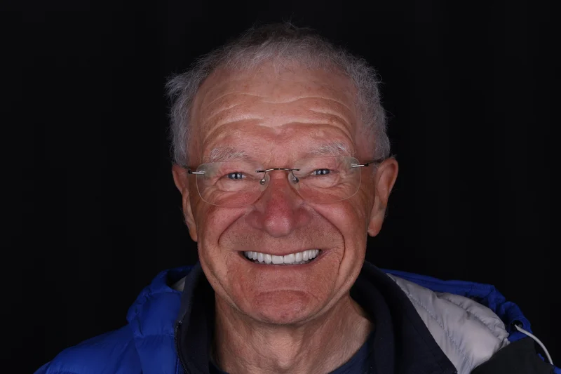 After treatment — dental implant patient comparison 01