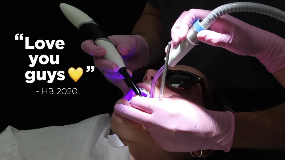 Orthodontic treatment at Smileworks, from the braces video.