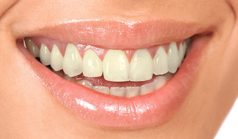 teeth whitening liverpool