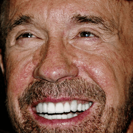 Chuck Norris White Teeth