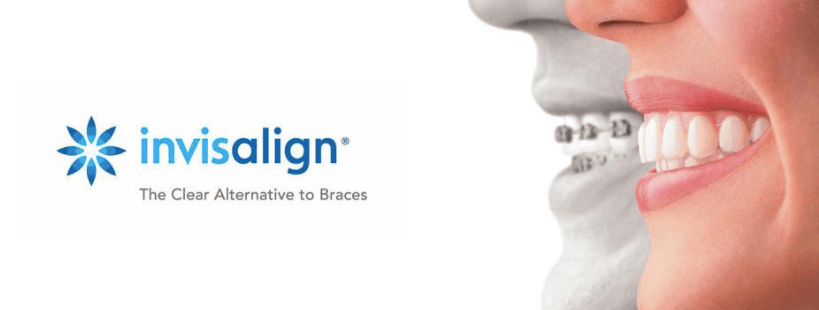 Invisalign® liverpool