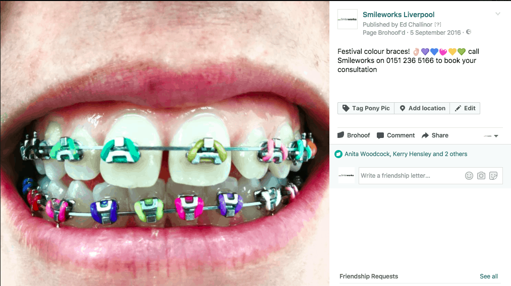 Remarkable Braces Liverpool From £46.50pcm *Free Whitening*