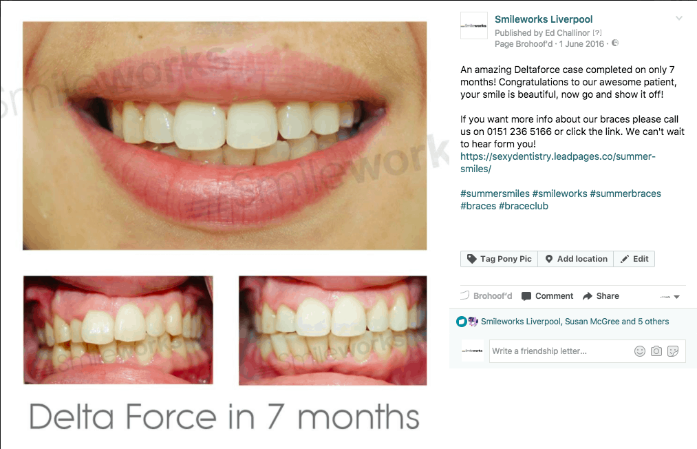 Remarkable Braces Liverpool From £46.50pcm *Free Whitening*