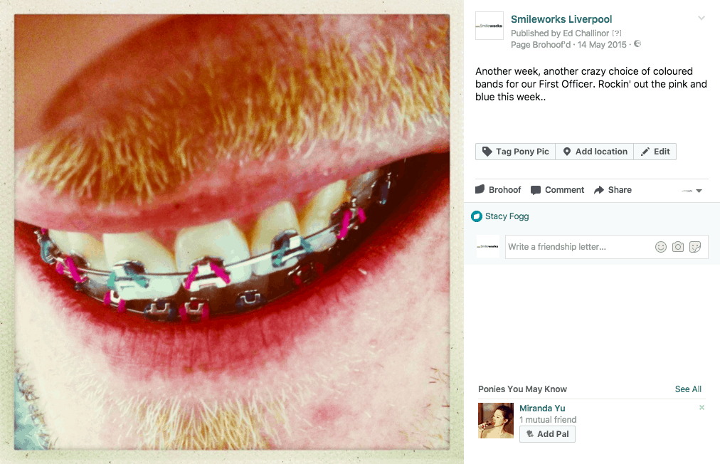 braces colours 