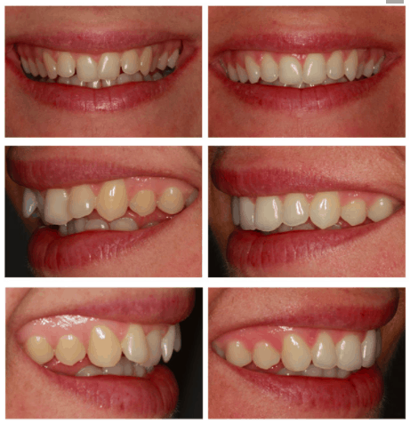 patient clinical before and after