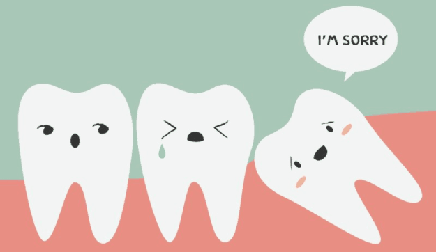 Wisdom tooth removal