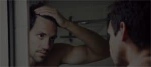 Hair Transplant Liverpool