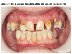 the state of the patient's dentition