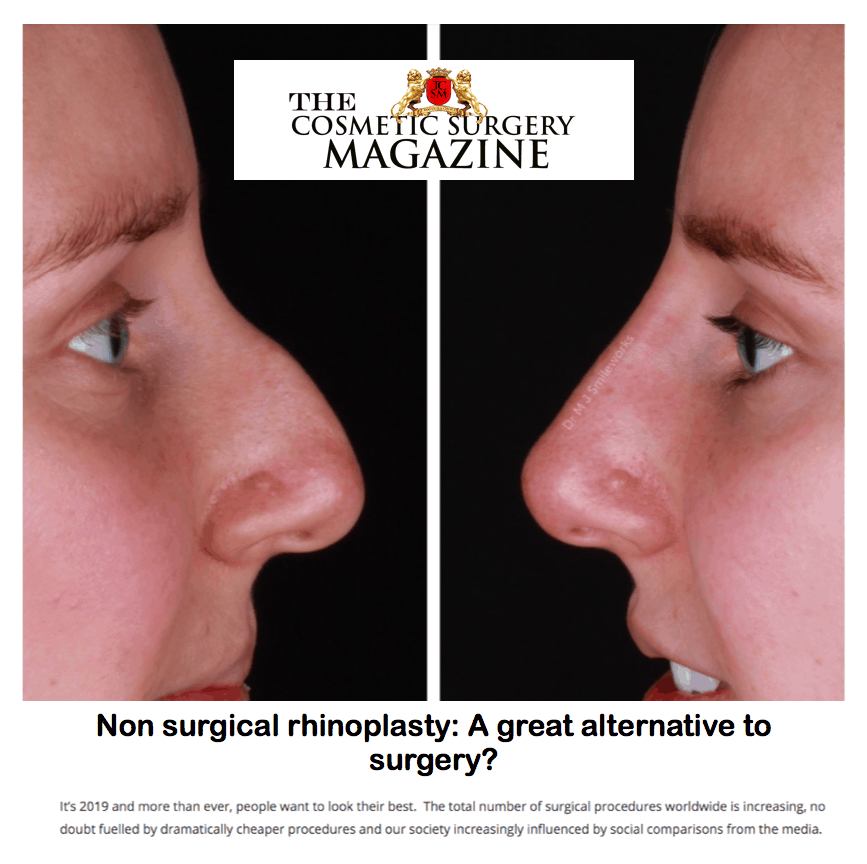 The Cosmetic Surgery Magazine
<br/>
<br/>
Non Surgical Rhinoplasty: A great alternative to surgery? 