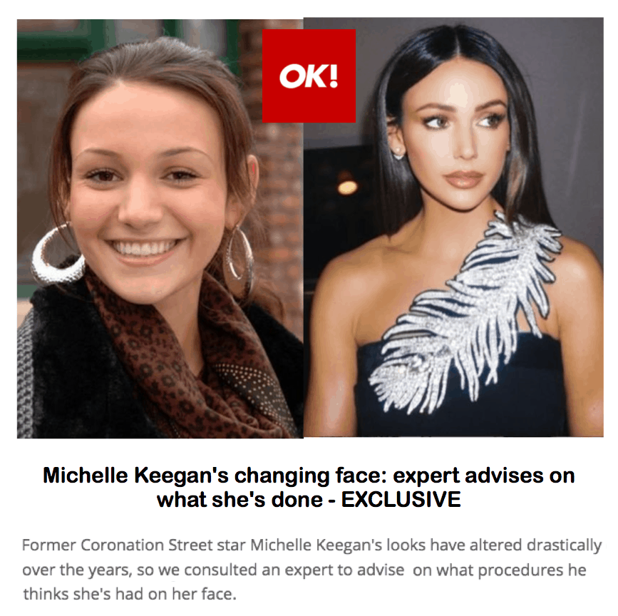 OK! Magazine
<br/>
<br/>
Michelle Keegan’s changing face: expert advises on what she's had done - EXCLUSIVE