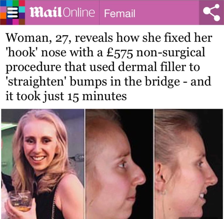 Mail Online Nose