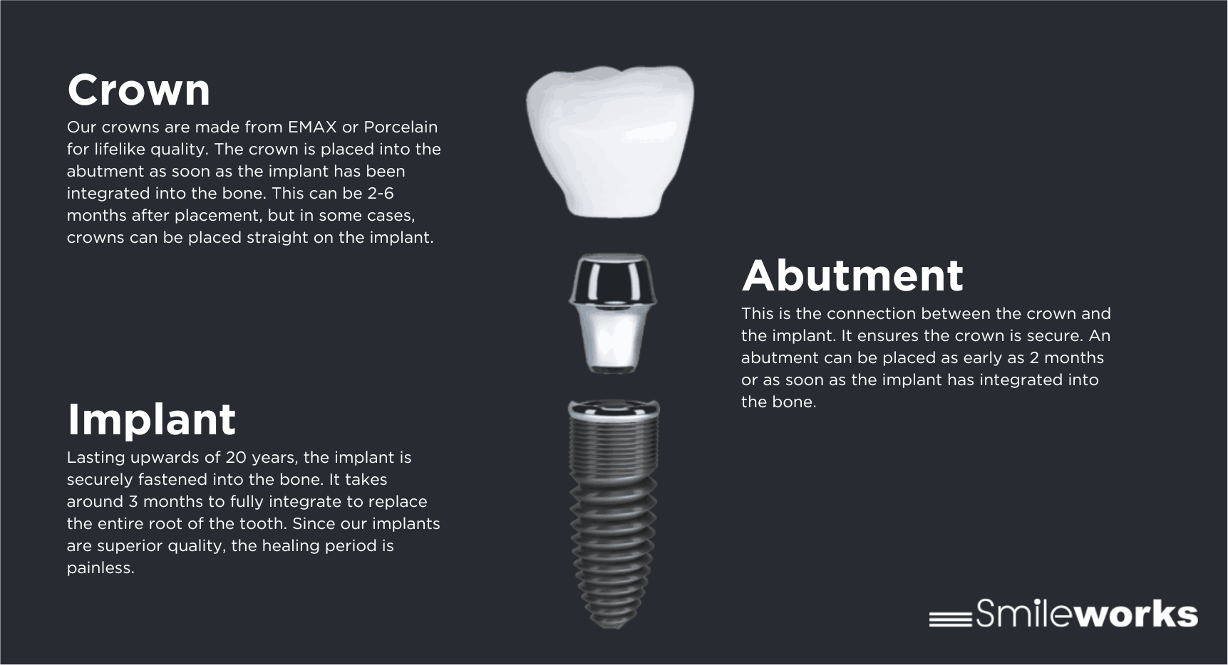 Implant Infographic Implant Infographic