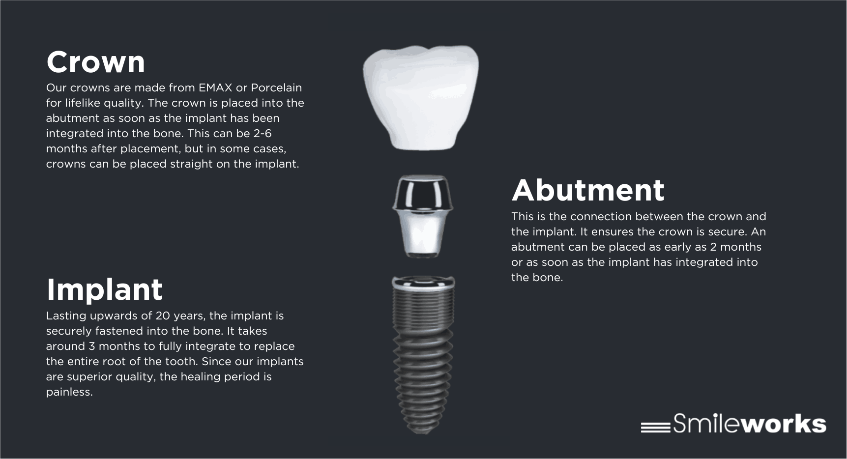 Implant Infographic