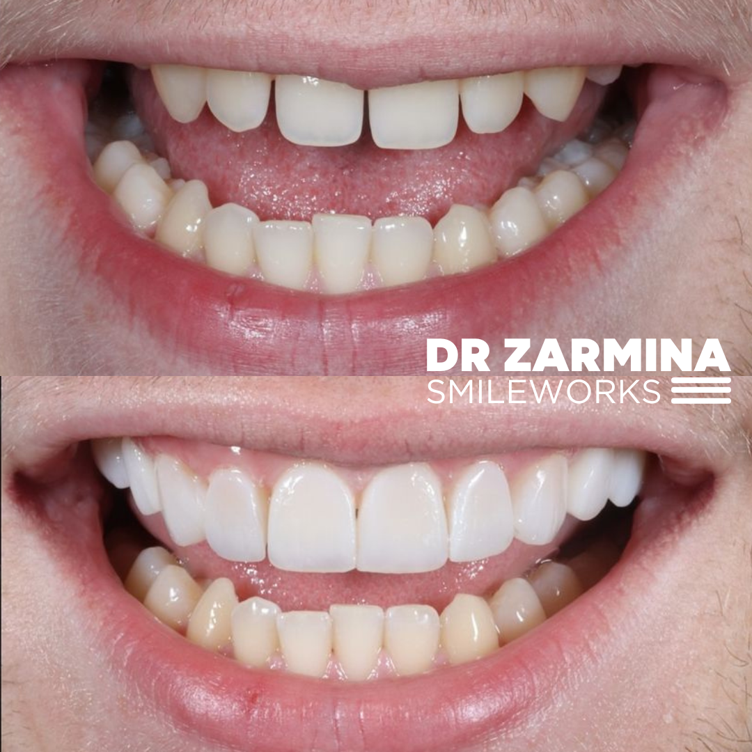 zarmina smile makeover zarmina smile makeover