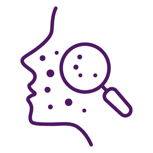 polynucleotides acne scars