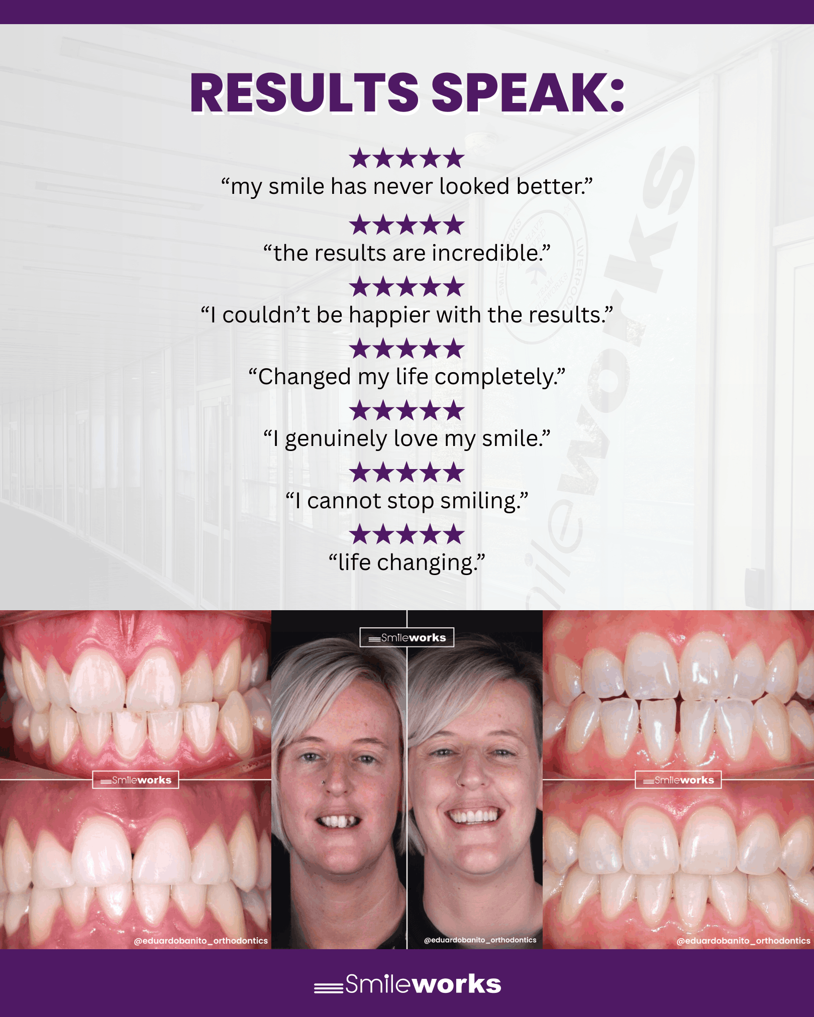 invisalign smileworks reviews