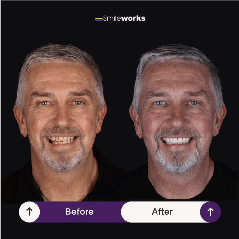 cosmetic dentist liverpool