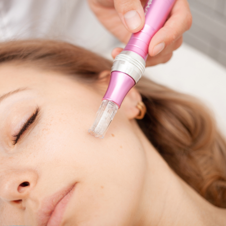 microneedling microneedling